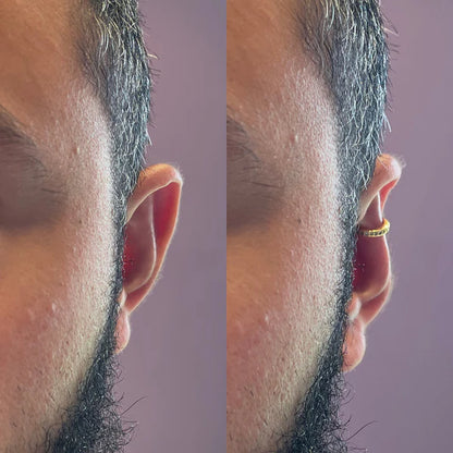 Earfix – Pendiente reutilizable para un Look Natural que Armoniza tu Rostro